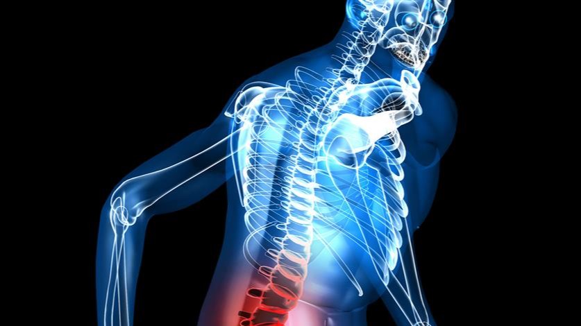 حرکات درمانی آرتروز